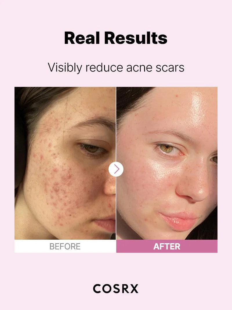 COSRX Siero alla niacinamide 15 20ml